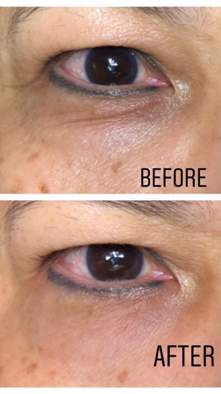 CBD Rapid Anti-Aging Serum